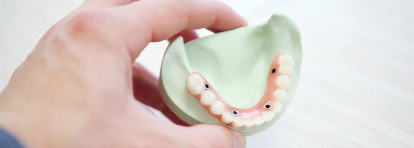 Čelične konstrukcije | Zubna tehnika
